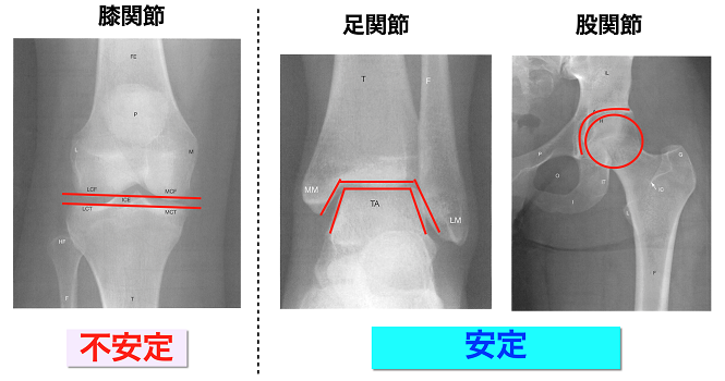 図①: 膝、股関節、足関節の構造